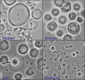 Four_common_forms_of_Blastocystis_hominis_Valzn